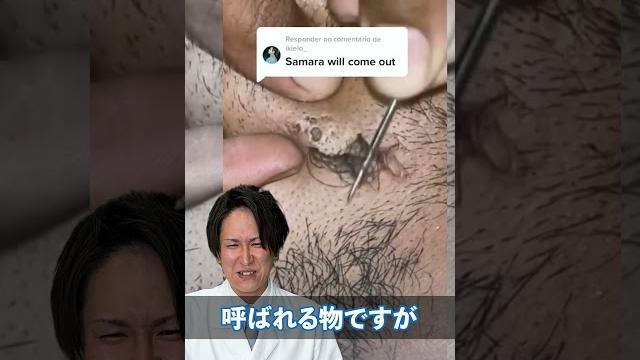 ここまでのものは見たことないですね〜#脱毛#脱毛サロン#メンズ脱毛#コメント ここまでのものは見たことないですね〜#脱毛#脱毛サロン#メンズ脱毛#コメント