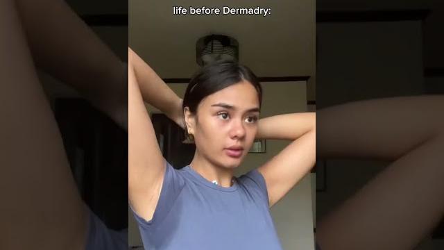 The dermadry difference ️ your solution for sweaty underarms! The dermadry difference ️ your solution for sweaty underarms!