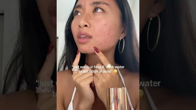 Acne girlies understand the struggle #acne #skincare #acnepositivity #acnefree #acneproneskin Acne girlies understand the struggle #acne #skincare #acnepositivity #acnefree #acneproneskin