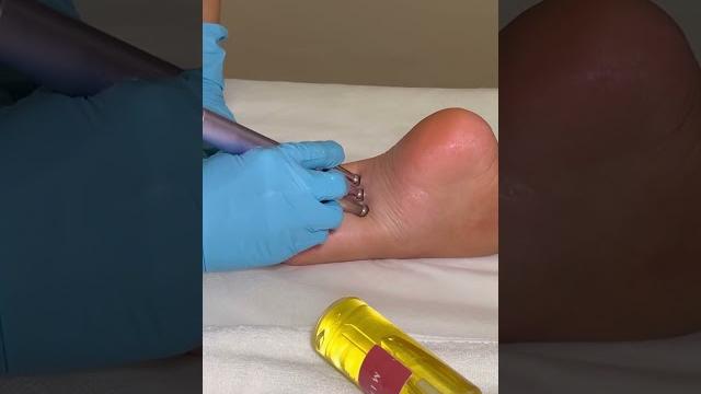 Asmr: super relaxing lymphatic massage #shorts Asmr: super relaxing lymphatic massage #shorts