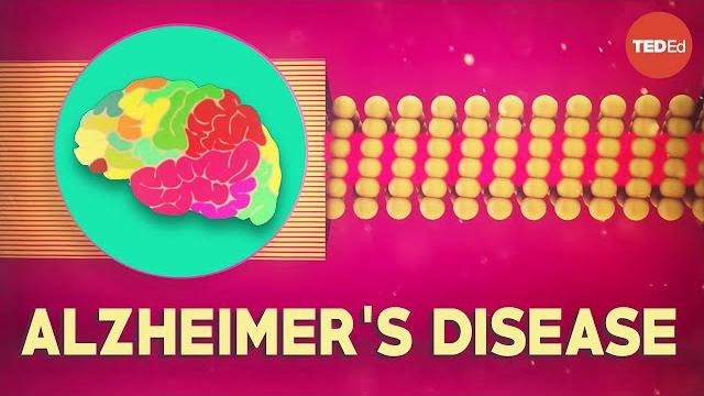 What is alzheimer's disease? - ivan seah yu jun What is alzheimer's disease? - ivan seah yu jun
