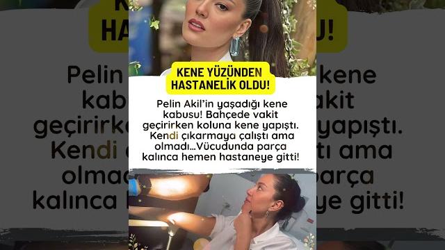 Peli̇n aki̇l kene yüzünden hastaneli̇k oldu! keneni̇n parçasi i̇çi̇nde kalinca korku dolu anlar yaşan Peli̇n aki̇l kene yüzünden hastaneli̇k oldu! keneni̇n parçasi i̇çi̇nde kalinca korku dolu anlar yaşan