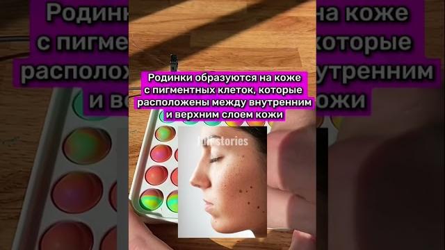 Из-за чего у тебя появляются родинки? Из-за чего у тебя появляются родинки?