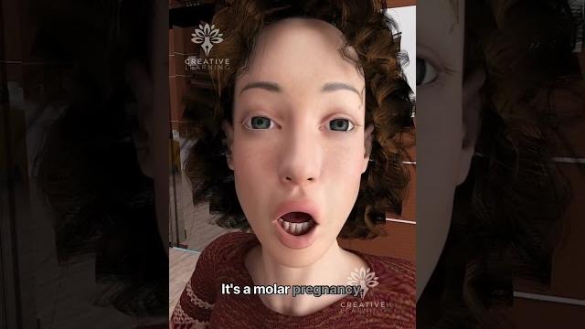 She thought she was pregnant… but it wasn’t a baby #short #viralvideo - creativelearning3d She thought she was pregnant… but it wasn’t a baby #short #viralvideo - creativelearning3d