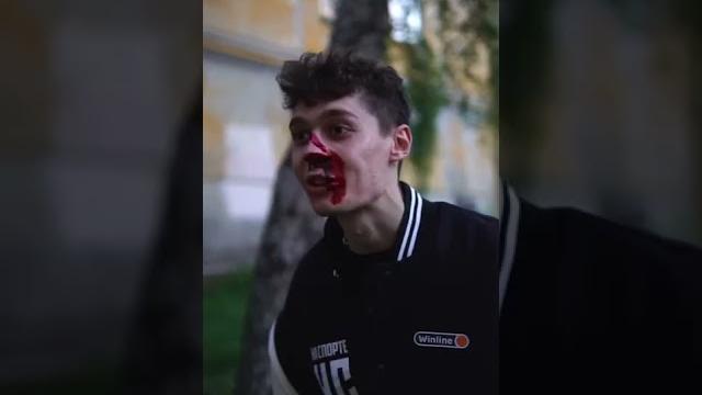 Fake bloodfake conflict согласны с гуфи?? #story Fake bloodfake conflict согласны с гуфи?? #story