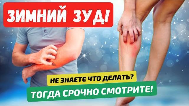 Зимний зуд как с ним бороться? симптомы, причины и лечение сильного зуда и сухости кожи у взрослых. Зимний зуд как с ним бороться? симптомы, причины и лечение сильного зуда и сухости кожи у взрослых.