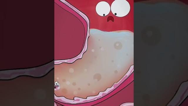 Water causes diarrhea Water causes diarrhea