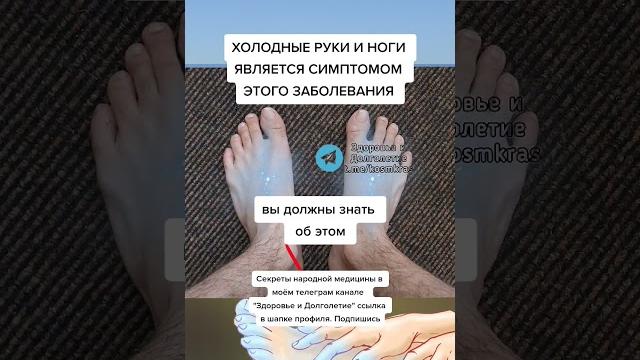 Холодные руки и ноги является симптомом этого заболевания #народныерецепты #народнаямедицина #зож Холодные руки и ноги является симптомом этого заболевания #народныерецепты #народнаямедицина #зож