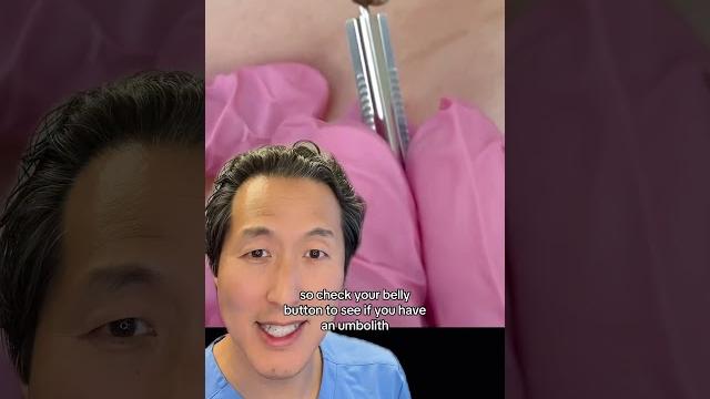 Do you have a rock in your belly button? #bellybutton Do you have a rock in your belly button? #bellybutton