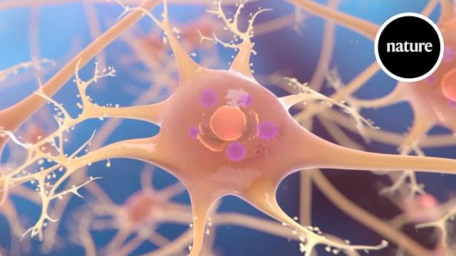 Understanding parkinson's disease Understanding parkinson's disease