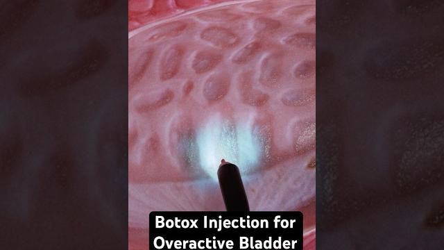 Botox for bladder control (3d animation) Botox for bladder control (3d animation)