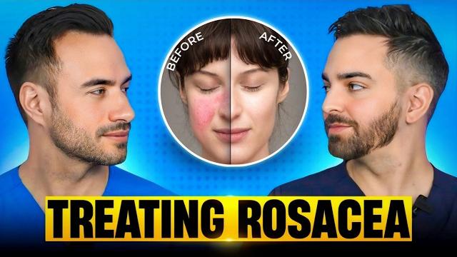 Treat rosacea like a dermatologist Treat rosacea like a dermatologist