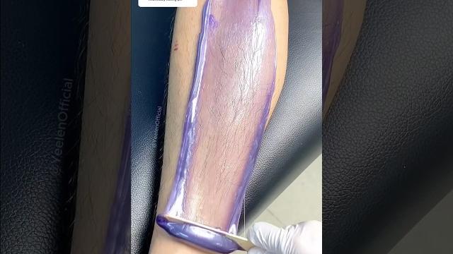 Long hair removal using hard wax #waxbeads #wax #hairremoval #hairremovalproducts #asmr #yeelen Long hair removal using hard wax #waxbeads #wax #hairremoval #hairremovalproducts #asmr #yeelen