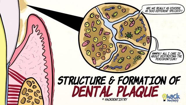 Dental plaque: structure and formation Dental plaque: structure and formation