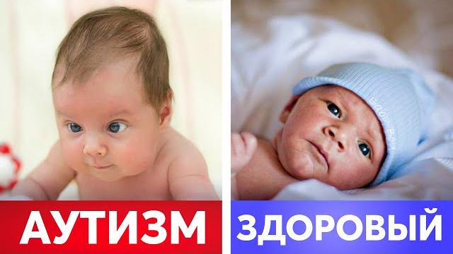 Ранние признаки аутизма! должен знать каждый родитель! Ранние признаки аутизма! должен знать каждый родитель!
