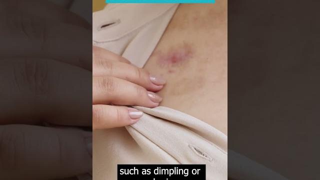 Breast cancer symptoms: a 30-second guide #artofhealingcancer #30secknowledge #youtubeshorts Breast cancer symptoms: a 30-second guide #artofhealingcancer #30secknowledge #youtubeshorts