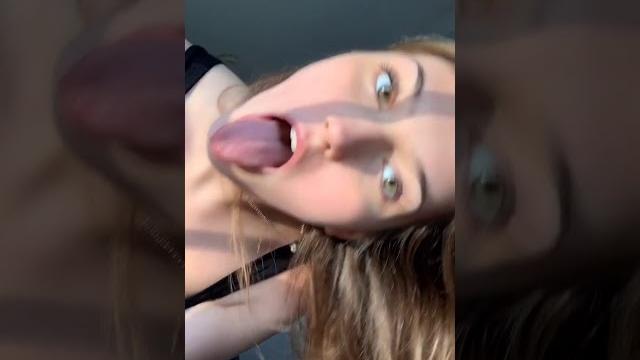 Uvula peaking Uvula peaking