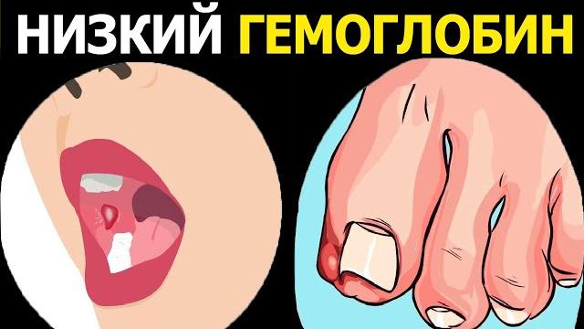 Каждый должен знать это! чем опасен низкий гемоглобин - риск, который нельзя игнорировать Каждый должен знать это! чем опасен низкий гемоглобин - риск, который нельзя игнорировать
