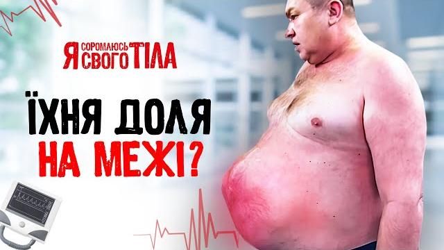 Недуг, который отбирает желание жить! – я соромлюсь свого тіла | медицина | врачи | здоровье Недуг, который отбирает желание жить! – я соромлюсь свого тіла | медицина | врачи | здоровье