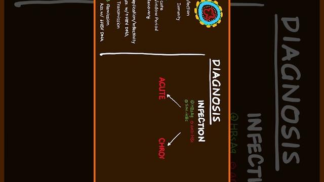 Part 1/3 hepatitis b diagnosis #usmle Part 1/3 hepatitis b diagnosis #usmle