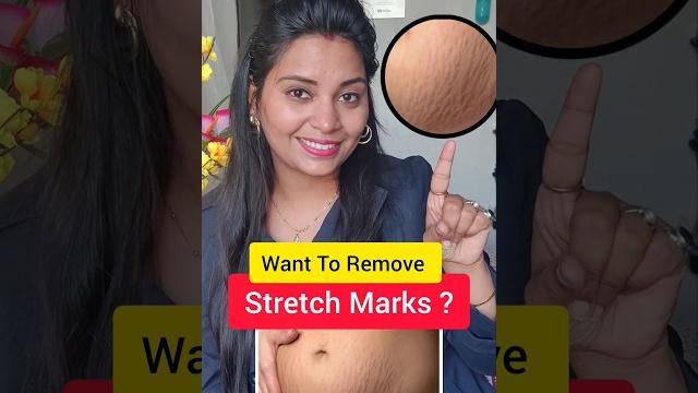 Stretch marks removal pharmacy creams #ankitasinghkuntal #stretchmarks #ytshorts #shorts #viral Stretch marks removal pharmacy creams #ankitasinghkuntal #stretchmarks #ytshorts #shorts #viral