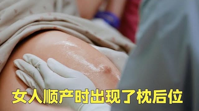 女人生产时出现了枕后位,助产士徒手将胎位调转了过来 女人生产时出现了枕后位,助产士徒手将胎位调转了过来