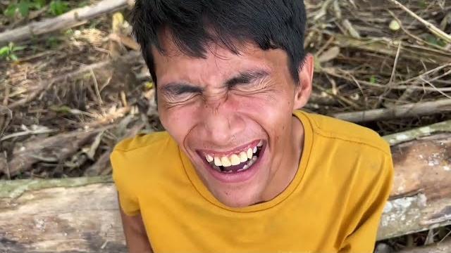 Palpak nga pagka tuli part 2 Palpak nga pagka tuli part 2