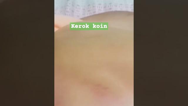 Kerok koin ala mbah maryono #shots Kerok koin ala mbah maryono #shots