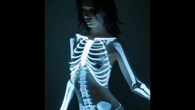 Nude x-ray dance #women #naked #nude #xray #dance Nude x-ray dance #women #naked #nude #xray #dance