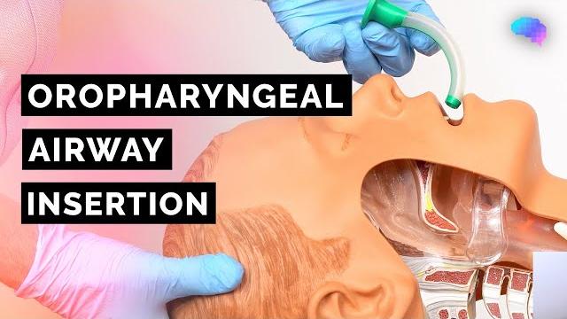 Oropharyngeal airway insertion | guedel | opa | abcde emergency | osce guide | ukmla | cpsa | plab 2 Oropharyngeal airway insertion | guedel | opa | abcde emergency | osce guide | ukmla | cpsa | plab 2