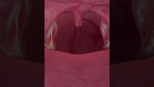 Why you should never have your tonsils removed Why you should never have your tonsils removed