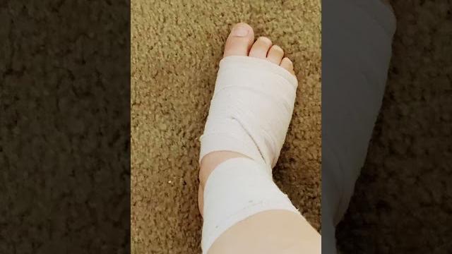 Guess who sprained her ankle check Guess who sprained her ankle check