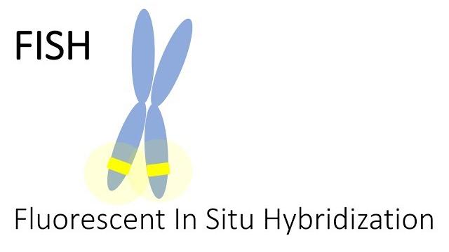 Fish - fluorescent in situ hybridization Fish - fluorescent in situ hybridization