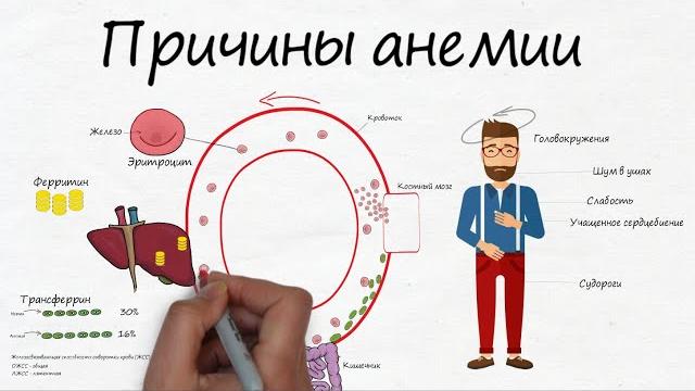 Анемия. когда симптомов много, а причина одна. Анемия. когда симптомов много, а причина одна.