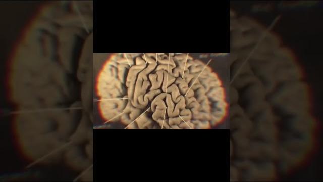 Что случилось с мозгом эйнштейна?! #shorts Что случилось с мозгом эйнштейна?! #shorts
