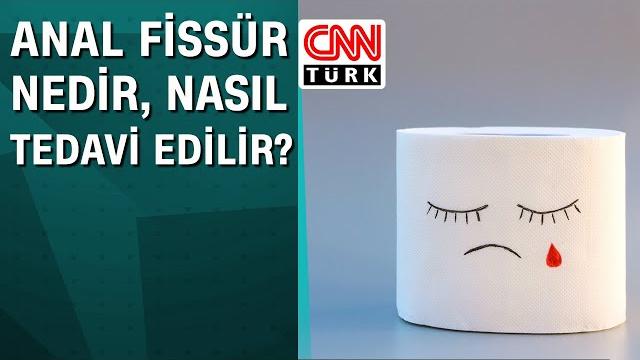 Anal fissür nedir, nasıl tedavi edilir? Anal fissür nedir, nasıl tedavi edilir?