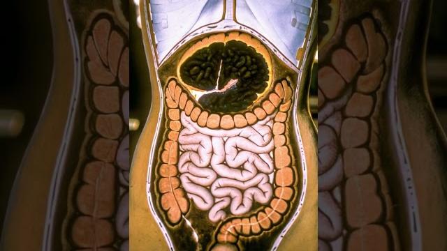 How constipation blocks the colon lumen | human anatomy | digestive system | stomach ai art | 09 How constipation blocks the colon lumen | human anatomy | digestive system | stomach ai art | 09