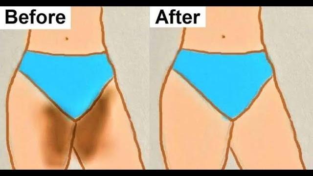 Lighten dark private part | vagina whitening | home remedy | 16 singaar | #shorts #ytshorts Lighten dark private part | vagina whitening | home remedy | 16 singaar | #shorts #ytshorts