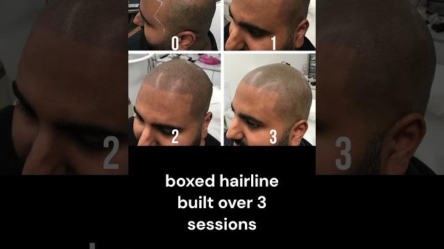 From bald to bold. get a sharp and defined boxed hairline with scalp micropigmentation #smp #shorts From bald to bold. get a sharp and defined boxed hairline with scalp micropigmentation #smp #shorts