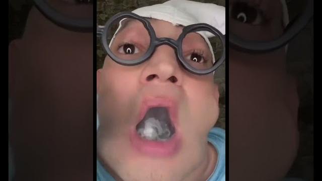 Yandimmmmm | gözlüklü şi̇ri̇n Yandimmmmm | gözlüklü şi̇ri̇n