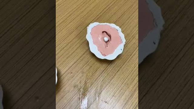 Prosthetic ear impression making part 3. #prosthetics #ear #impression #makingvideos #dentist Prosthetic ear impression making part 3. #prosthetics #ear #impression #makingvideos #dentist
