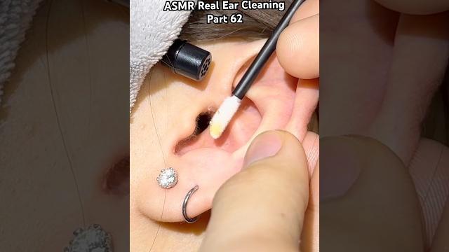 Part 62 | asmr ear cleaning #asmr #earcleaning Part 62 | asmr ear cleaning #asmr #earcleaning