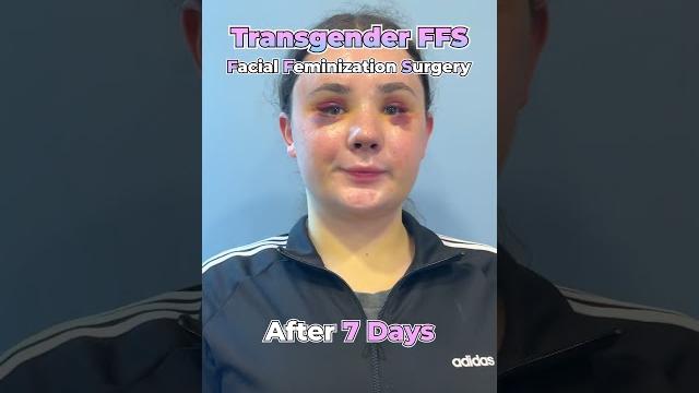 See a transgender's transformation ! #ffs ️️ See a transgender's transformation ! #ffs ️️