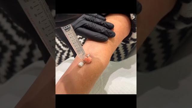 Iv cannulation procedure: step-by-step guide for nurses|"iv insertion technique | cannula insertion Iv cannulation procedure: step-by-step guide for nurses|"iv insertion technique | cannula insertion
