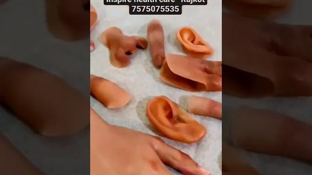 Silicone cosmetic prosthesis Silicone cosmetic prosthesis