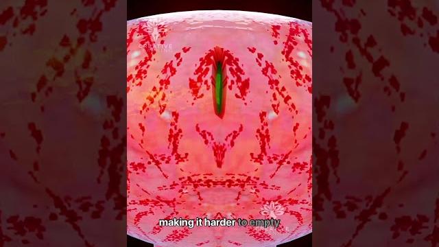 What happens when you hold pee for too long #short #urineinfection - creativelearning3d What happens when you hold pee for too long #short #urineinfection - creativelearning3d