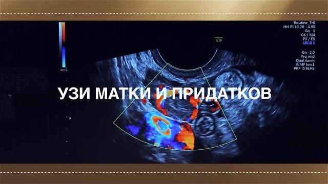 Узи матки и придатков Узи матки и придатков