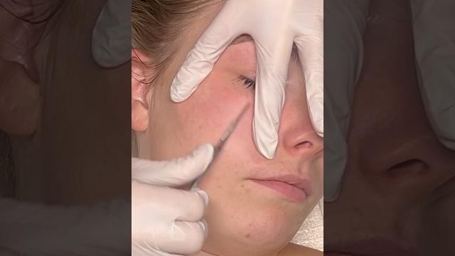 Zzz asmr dermaplaning Zzz asmr dermaplaning