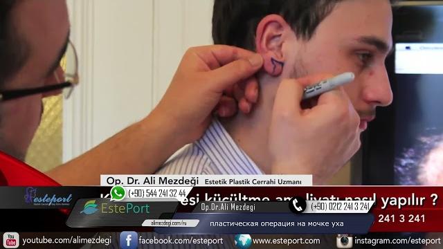 Пластическая операция на мочке уха Пластическая операция на мочке уха