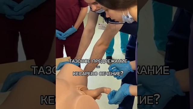 Тазовые роды Тазовые роды